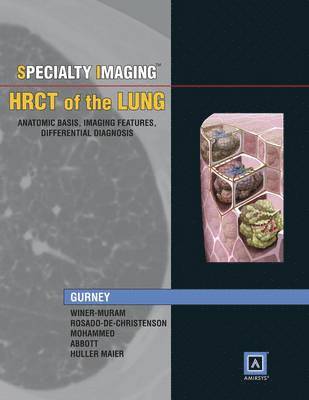 bokomslag Specialty Imaging: HRCT of the Lung