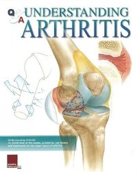 bokomslag Understanding Arthritis Flip Chart