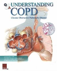 bokomslag Understanding COPD Flip Chart