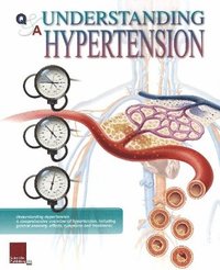 bokomslag Understanding Hypertension Flip Chart