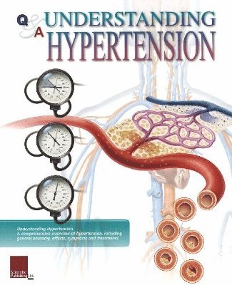 Understanding Hypertension Flip Chart 1