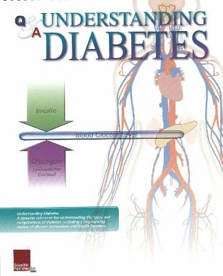 Understanding Diabetes Flip Chart 1