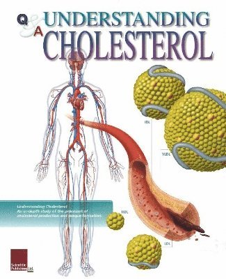 bokomslag Understanding Cholesterol Flip Chart