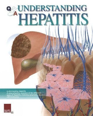 bokomslag Understanding Hepatitis Flip Chart