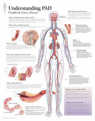 bokomslag Understand Peripheral Artery D