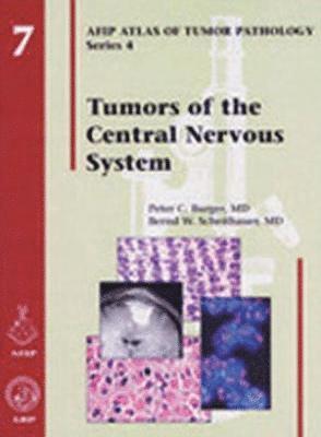 Peter C. Burger, Bernd W. Scheithauer - Tumors of the Central Nervous System, Inbunden