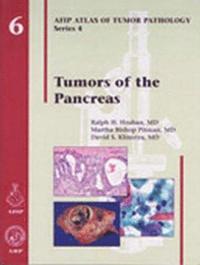 bokomslag Tumors of the Pancreas