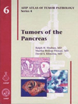 bokomslag Tumors of the Pancreas