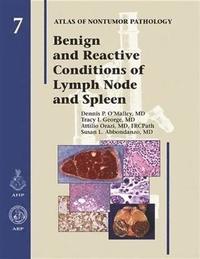 bokomslag Benign and Reactive Conditions of Lymph Node and Spleen