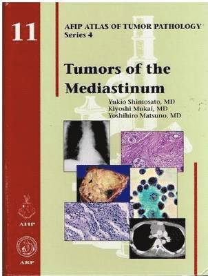 bokomslag Tumors of the Mediastinum