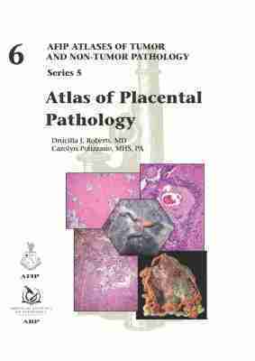 Drucilla J. Roberts, Carolyn Polizzano - Atlas of Placental Pathology, Inbunden