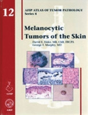 bokomslag Melanocytic Tumors of the Skin