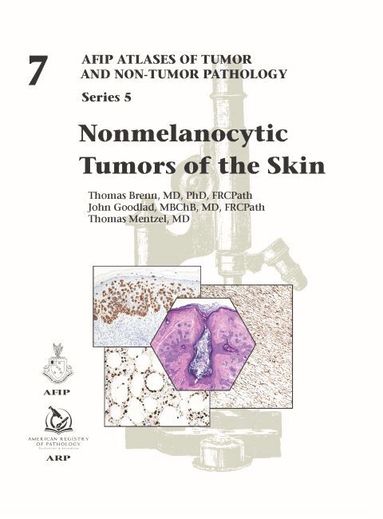 Thomas Brenn, John Goodlad, Thomas Mentzel - Nonmelanocytic Tumors of the Skin, Inbunden