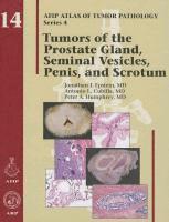 bokomslag Tumors of the Prostate Gland, Seminal Vesicles, Penis, and Scrotum