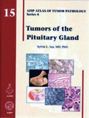 Sylvia L. Asa - Tumors of the Pituitary Gland, Inbunden