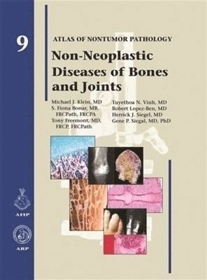 bokomslag Non-Neoplastic Diseases of Bones and Joints