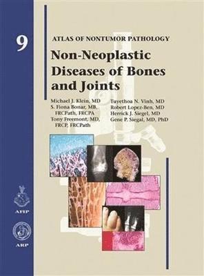 Non-Neoplastic Diseases of Bones and Joints 1