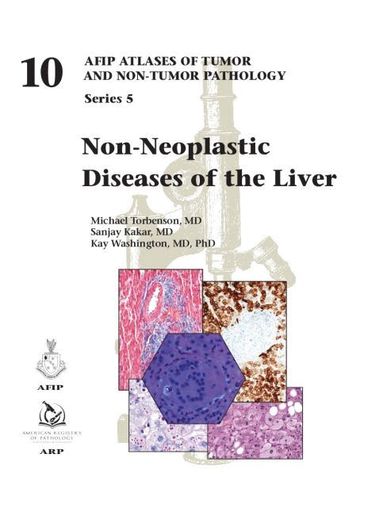 Michael Torbenson, Sanjay Kakar, Kay Washington - Non-Neoplastic Diseases of the Liver, Inbunden