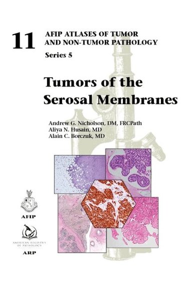 Andrew G. Nicholson, Aliya N. Husain, Alain C. Borczuk - Tumors of the Serosal Membranes, Inbunden