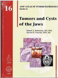 bokomslag Tumors and Cysts of the Jaws