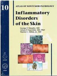 bokomslag Inflammatory Disorders of the Skin