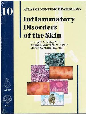 Inflammatory Disorders of the Skin 1
