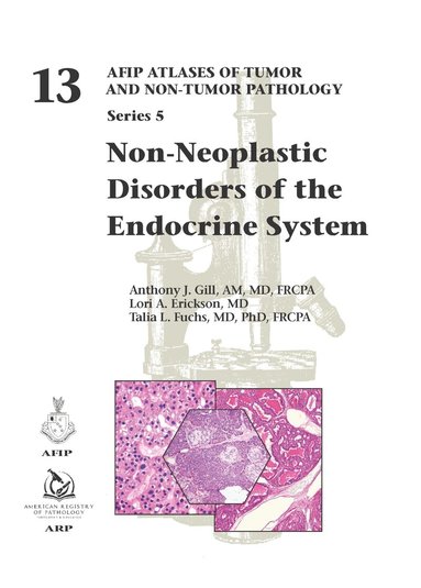 Anthony J. Gill, Lori A. Erickson, Talia L. Fuchs - Non-Neoplastic Disorders of the Endocrine System, Inbunden
