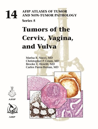 Marisa R. Nucci, Christopher P. Crum, Brooke E. Howitt, Carlos Parra-Herran - Tumors of the Cervix, Vagina, and Vulva, Inbunden
