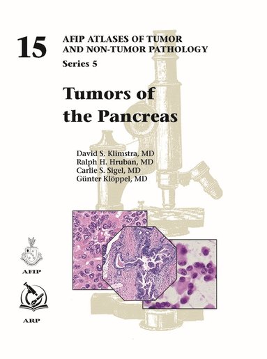 David S. Klimstra, Ralph H. Hruban, Carlie S. Sigel, Günter Klöppel - Tumors of the Pancreas, Inbunden
