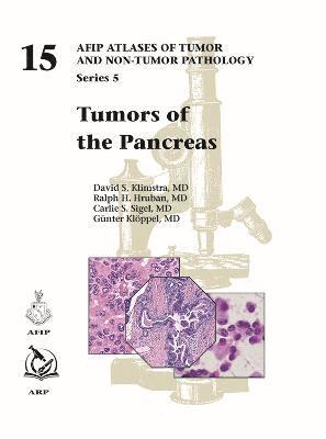 Tumors of the Pancreas 1