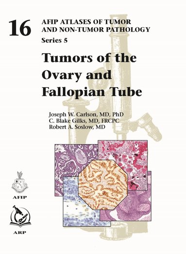 Joseph W. Carlson, C. Blake Gilks, Robert A. Soslow - Tumors of the Ovary and Fallopian Tube, Inbunden