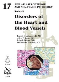 bokomslag Disorders of the Heart and Blood Vessels