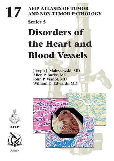 Joseph J. Maleszewski, Allen P. Burke, John P. Veinot, William D. Edwards - Disorders of the Heart and Blood Vessels, Inbunden