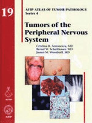 Tumors of the Peripheral Nervous System 1