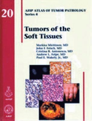 bokomslag Tumors of the Soft Tissues