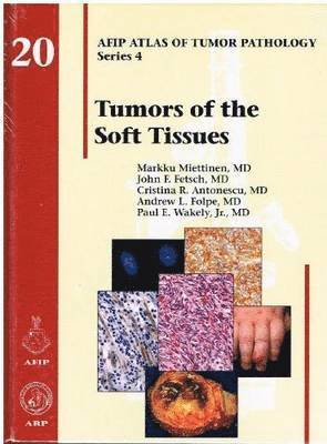 Tumors of the Soft Tissues 1