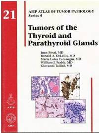 bokomslag Tumors of the Thyroid and Parathyroid Glands
