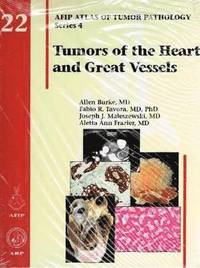 bokomslag Tumors of the Heart and Great Vessels