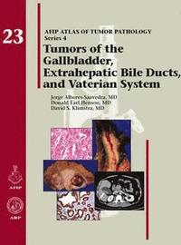 bokomslag Tumors of the Gallbladder, Extrahepatic Bile Ducts, and Vaterian System
