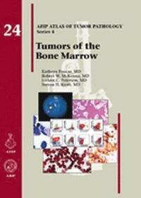 bokomslag Tumors of the Bone Marrow