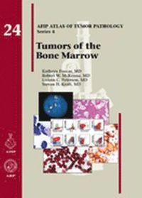 bokomslag Tumors of the Bone Marrow