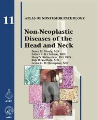 bokomslag Non-Neoplastic Diseases of the Head and Neck