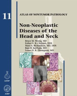 Bruce M. Wenig, Esther L. B. Childers, Mary S. Richardson, Raja R. Seethala, Lester D. R. Thompson - Non-Neoplastic Diseases of the Head and Neck, Inbunden