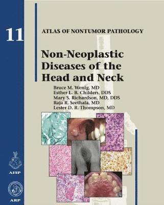 Non-Neoplastic Diseases of the Head and Neck 1