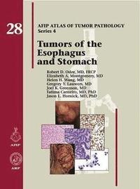 bokomslag Tumors of the Esophagus and Stomach