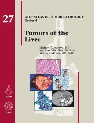 bokomslag Tumors of the Liver