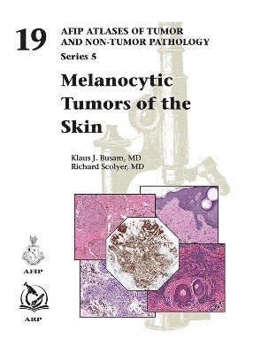 Klaus J. Busam, Richard Scolyer - Melanocytic Tumors of the Skin, Inbunden