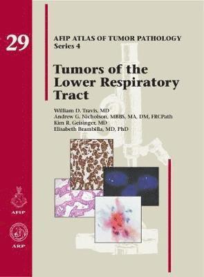William D. Travis, Andrew G. Nicholson, Kim R. Geisinger, Elisabeth Brambilla - Tumors of the Lower Respiratory Tract, Inbunden