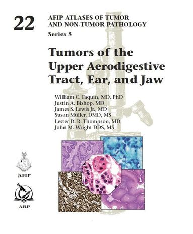 William C. Faquin, Justin A. Bishop, James S. Lewis Jr., Susan Müller, Lester D. R. Thompson, John M. Wright - Tumors of the Upper Aerodigestive Tract, Ear, and Jaw, Inbunden
