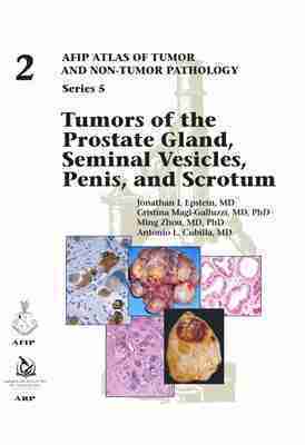 Jonathan I. Epstein, Cristina Magi-Galluzzi, Ming Zhou, Antonio L. Cubilla - Tumors of the Prostate Gland, Seminal Vesicles, Penis, and Scrotum, Inbunden